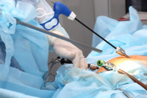 Laparoscopy Treatment in Jaipur