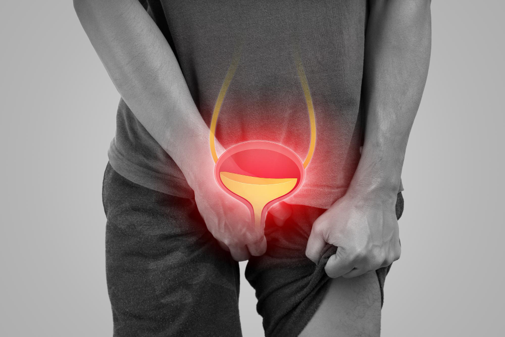 Bladder Stone Treatment: Symptoms, Causes, Diagnosis & Laser Surgery